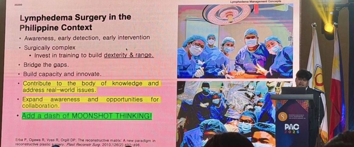 Dr. Cruz presenting on lymphedema surgery in the Philippine context